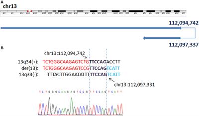 Whole Genome Low-Coverage Sequencing Concurrently Detecting Copy Number Variations and Their Underlying Complex Chromosomal Rearrangements by Systematic Breakpoint Mapping in Intellectual Deficiency/Developmental Delay Patients